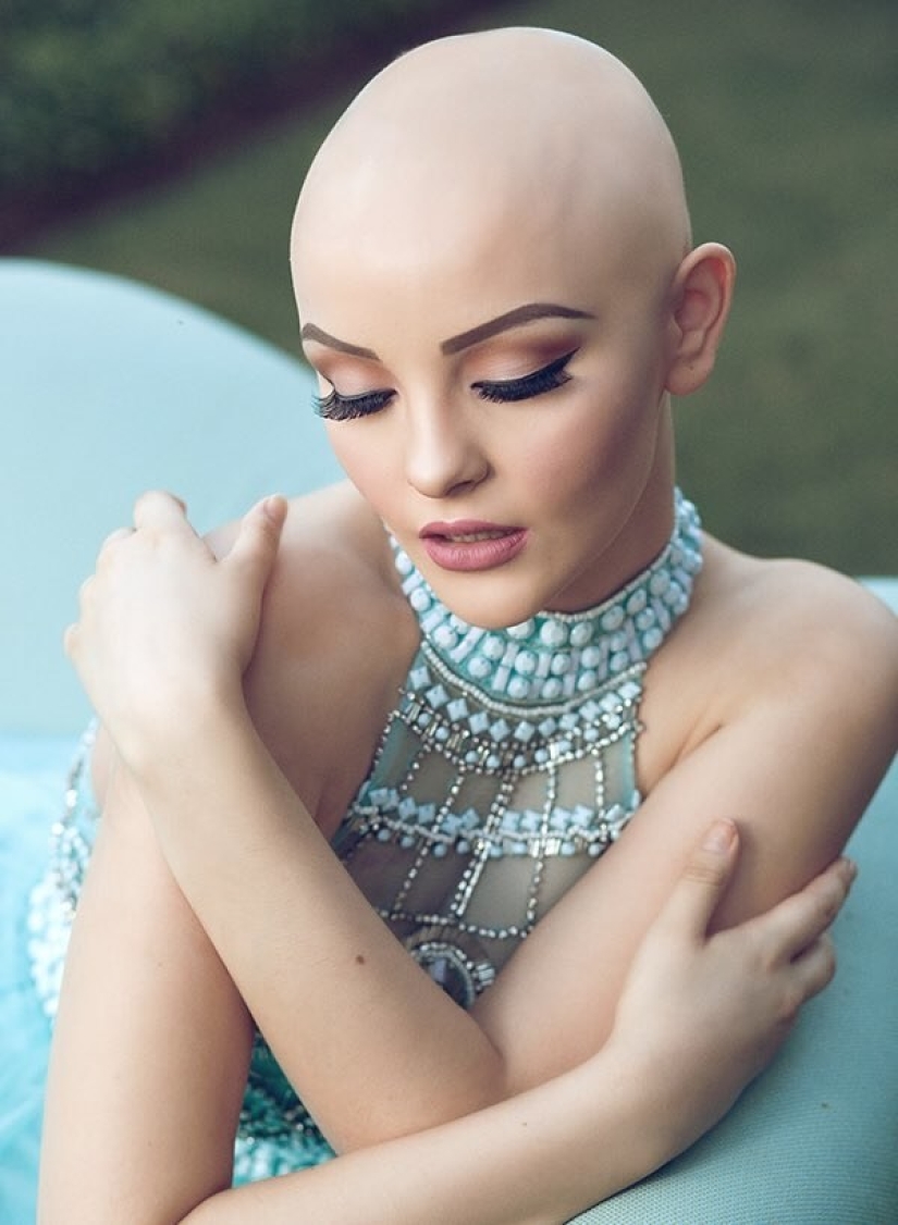 A 17-year-old girl struggling with cancer starred in a bold photo shoot without a wig A 17-year-old girl struggling with cancer starred in a bold photo shoot without a wig