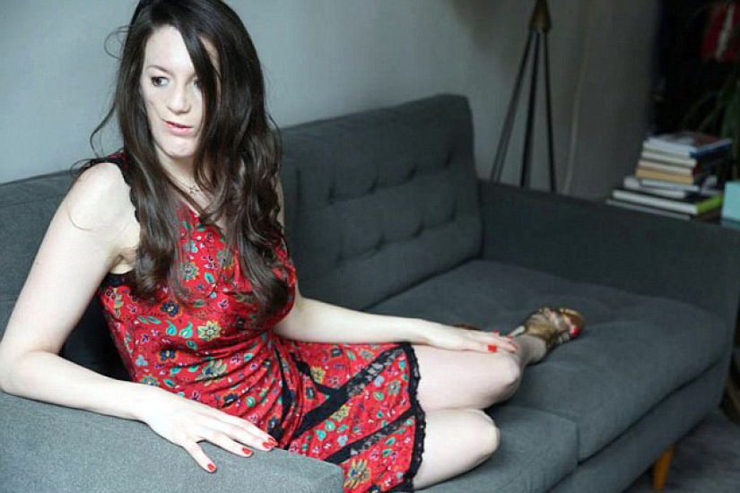 A girl with facial deformity became a fashion model, having survived more than 100 plastic surgeries