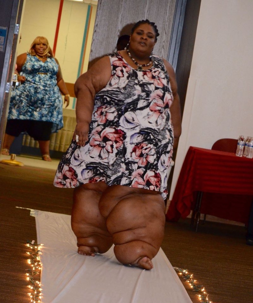 A girl with huge legs also dreams of a beautiful wedding