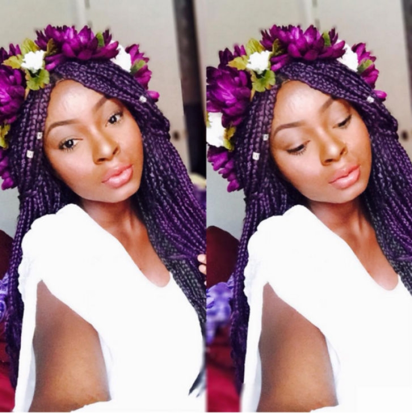 A girl with severe facial burns demonstrates the power of makeup