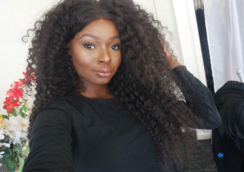 A girl with severe facial burns demonstrates the power of makeup