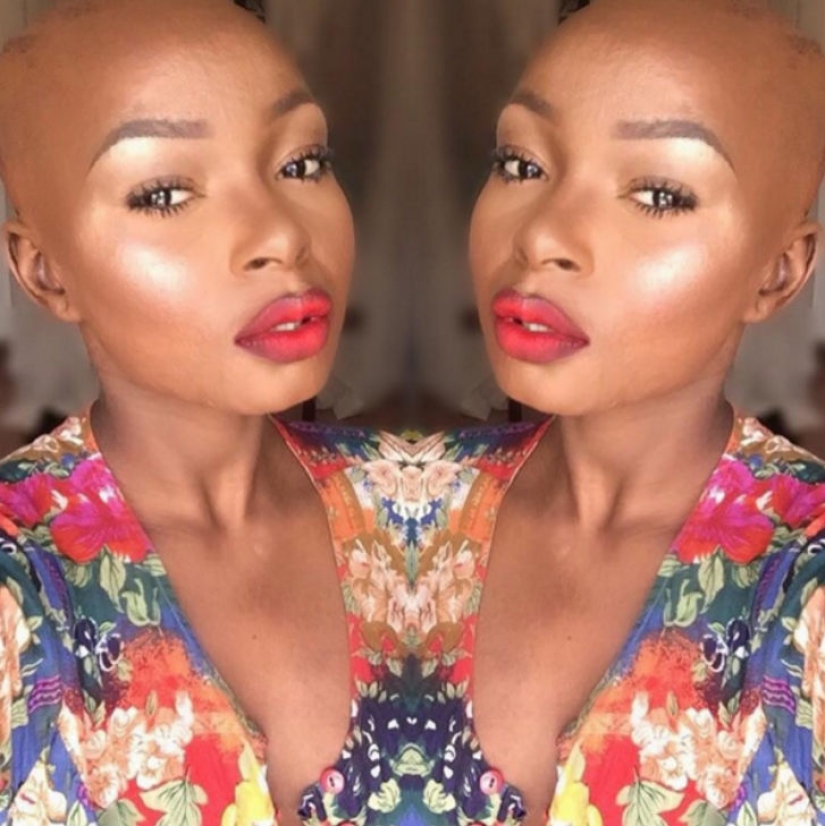 A girl with severe facial burns demonstrates the power of makeup