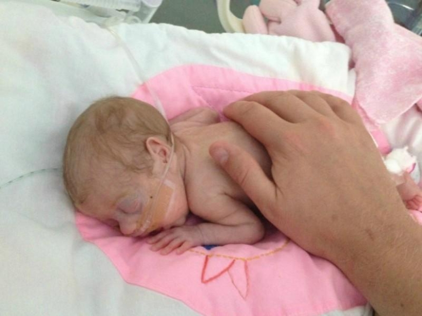 A touching story of a little baby