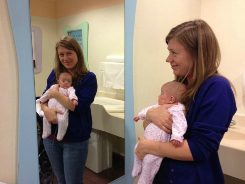 A touching story of a little baby