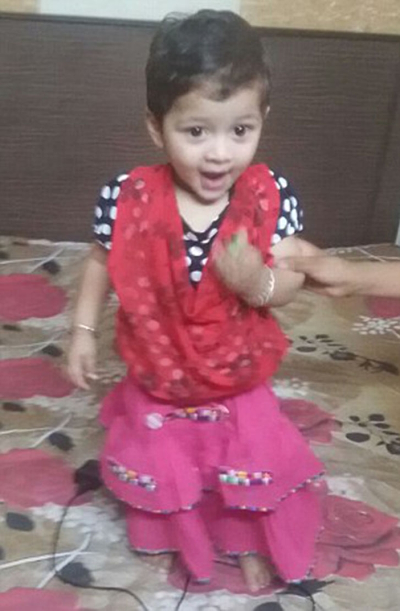 A two-year-old baby from India suffers from premature puberty A two-year-old baby from India suffers from premature puberty