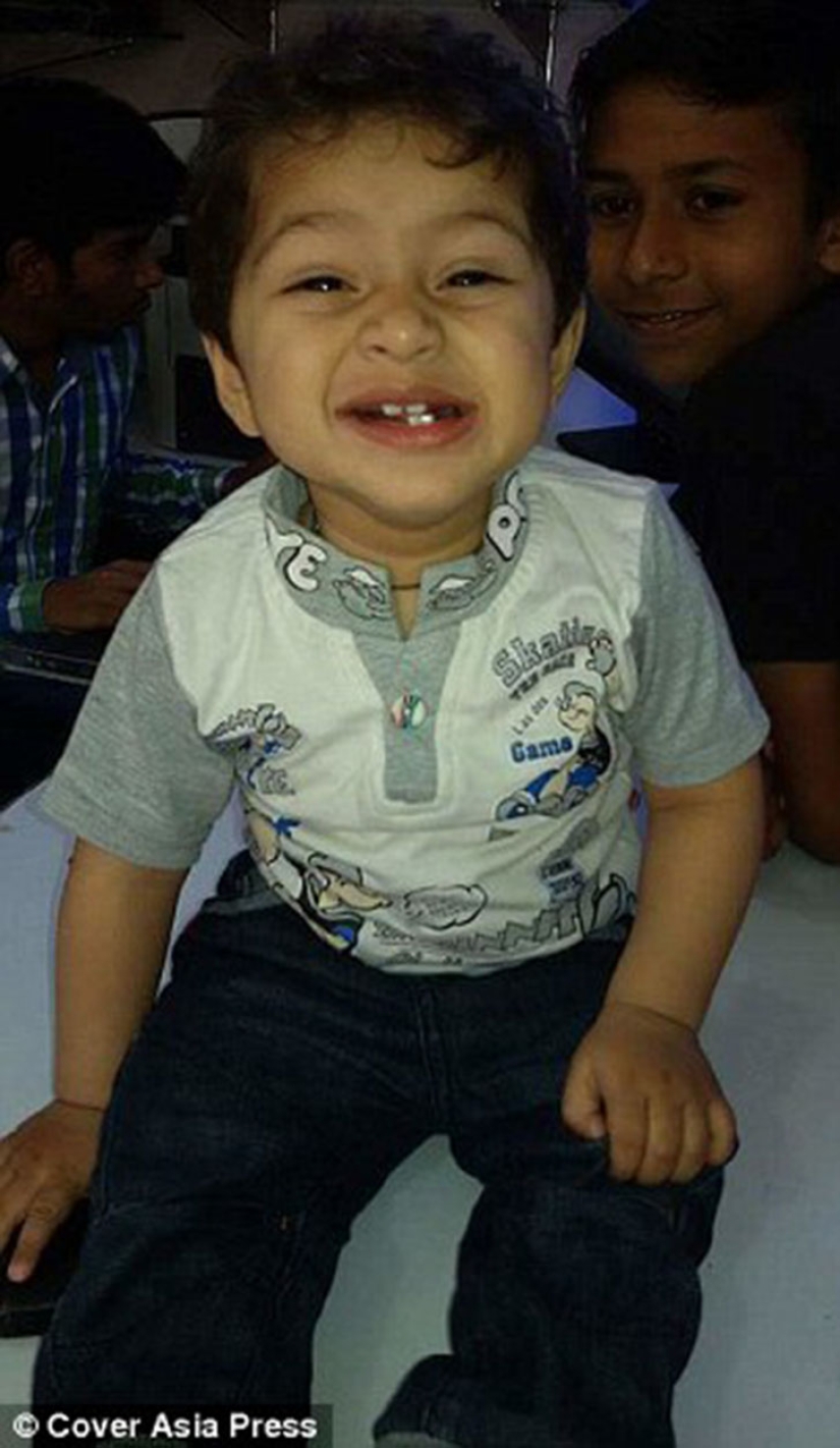 A two-year-old baby from India suffers from premature puberty A two-year-old baby from India suffers from premature puberty