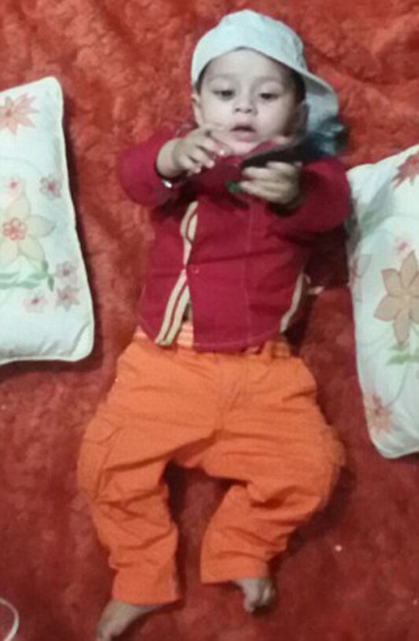 A two-year-old baby from India suffers from premature puberty A two-year-old baby from India suffers from premature puberty