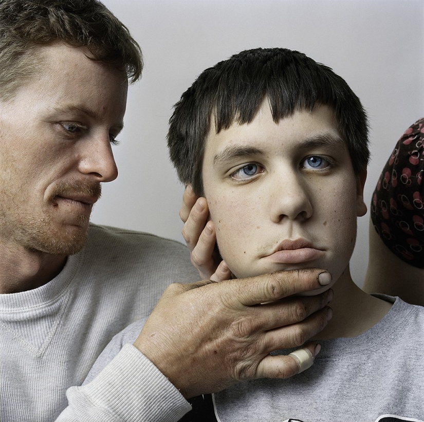 About Face: photo portraits of people suffering from paralysis