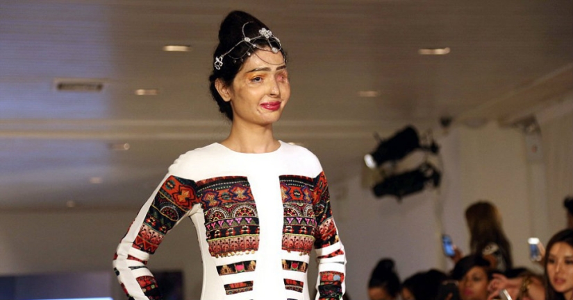 Acid dousing victim walked the runway at New York Fashion Week