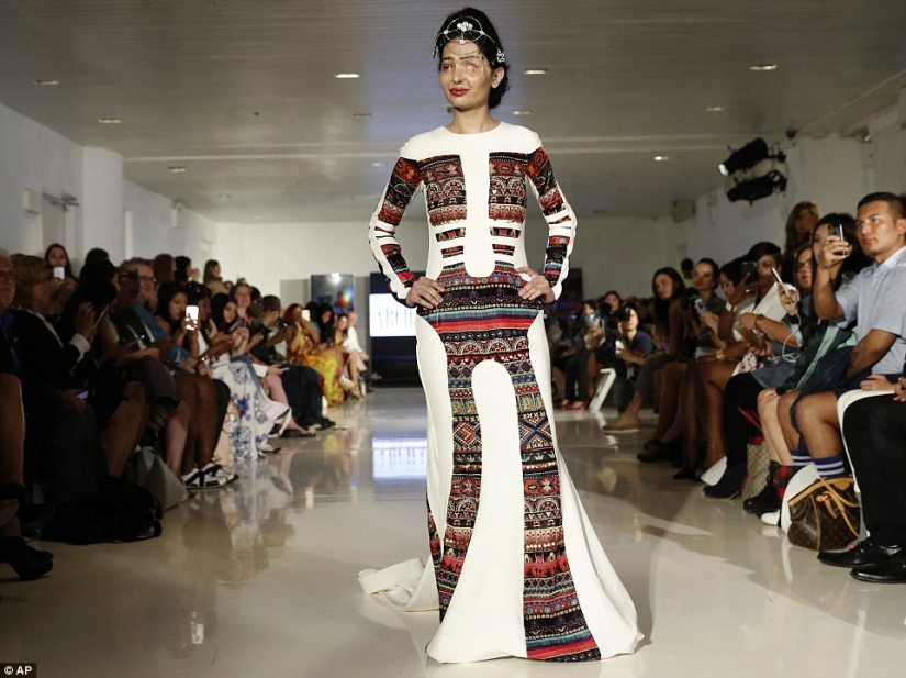 Acid dousing victim walked the runway at New York Fashion Week