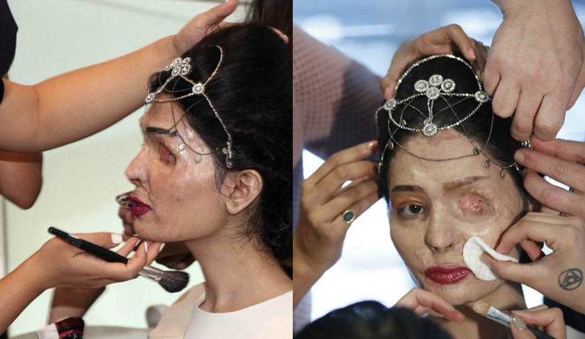 Acid dousing victim walked the runway at New York Fashion Week