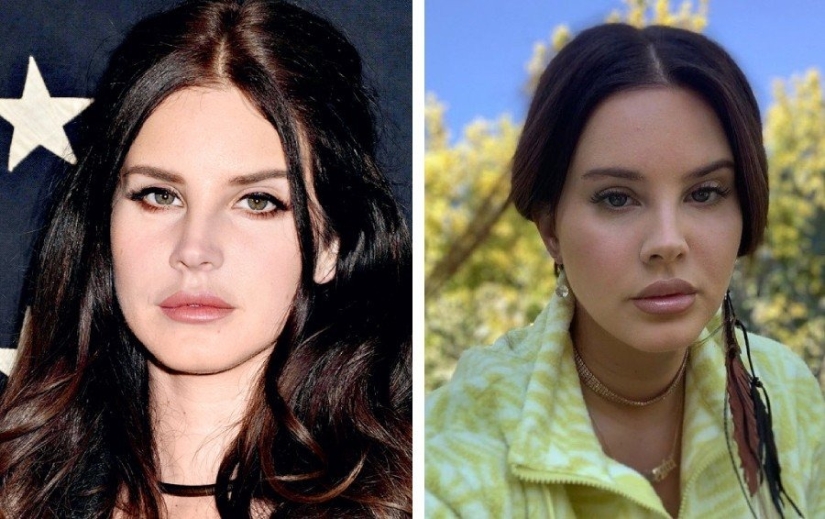 Almost like your own: 9 stars who knowingly made lip plastic surgery