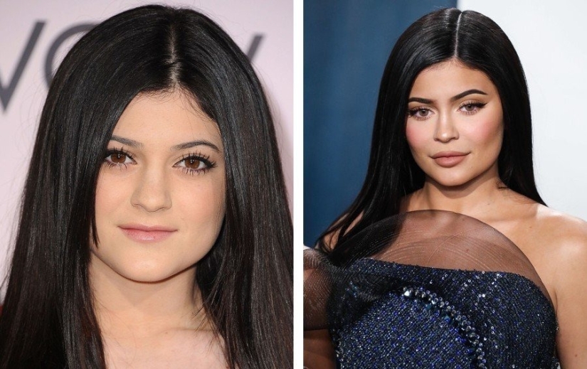 Almost like your own: 9 stars who knowingly made lip plastic surgery