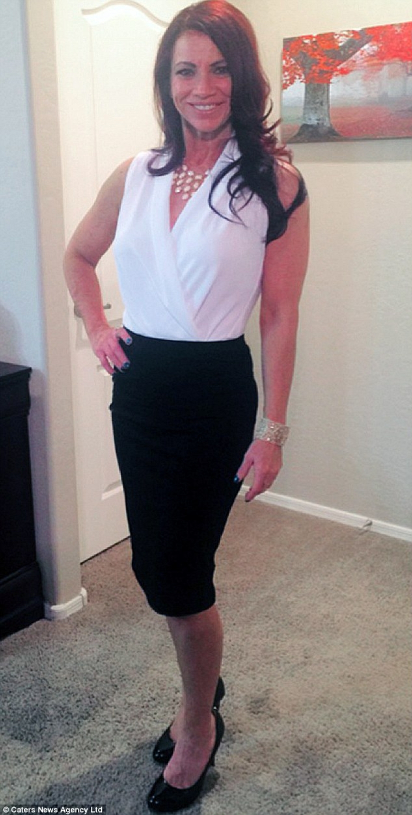 American woman defeated cancer and lost 50 kilograms to survive the death of her daughter