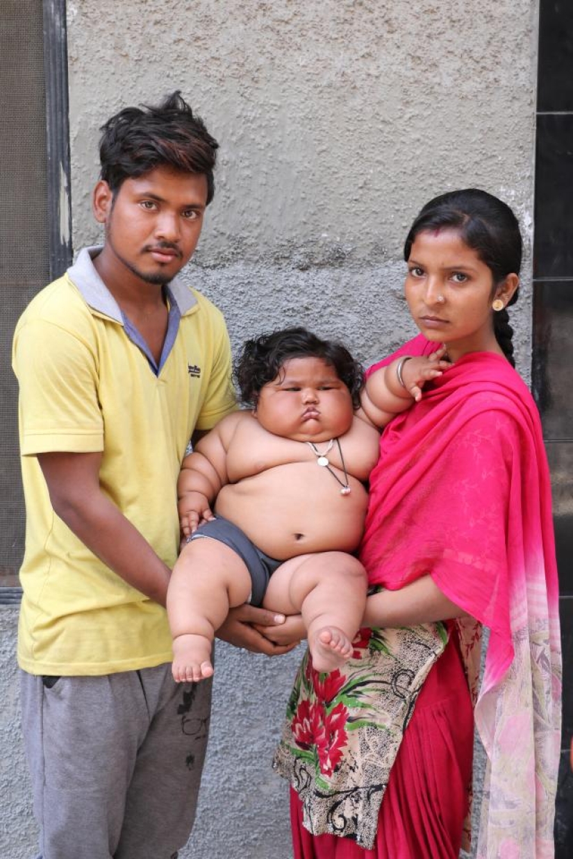 An 8-month-old girl weighs 17 kilograms, and doctors cannot diagnose her An 8-month-old girl weighs 17 kilograms, and doctors cannot diagnose her
