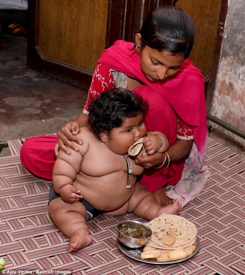 An 8-month-old girl weighs 17 kilograms, and doctors cannot diagnose her An 8-month-old girl weighs 17 kilograms, and doctors cannot diagnose her