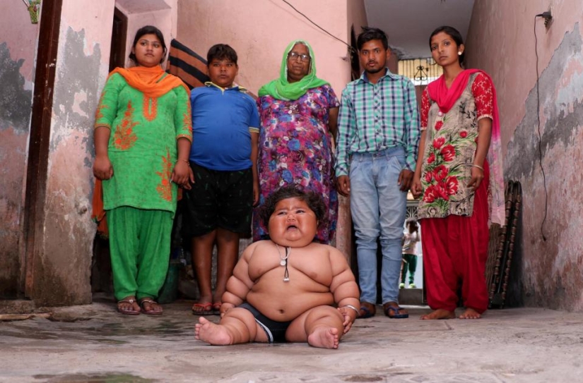 An 8-month-old girl weighs 17 kilograms, and doctors cannot diagnose her An 8-month-old girl weighs 17 kilograms, and doctors cannot diagnose her