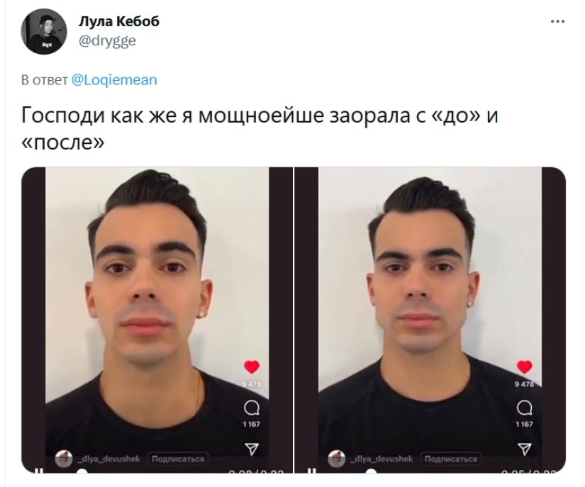 Angelina Jolie's cheekbones: what men look like before and after "beauty shots"