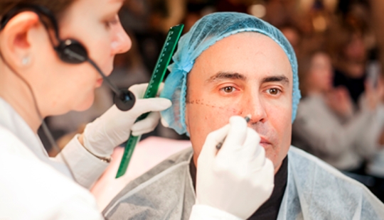 Angelina Jolie&#39;s cheekbones: what men look like before and after &quot;beauty shots&quot;