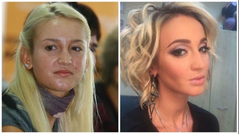 Antes de la fama y la cirugía plástica: 15 fotos de cómo eran las estrellas rusas en su juventud Antes de la fama y la cirugía plástica: 15 fotos de cómo eran las estrellas rusas en su juventud