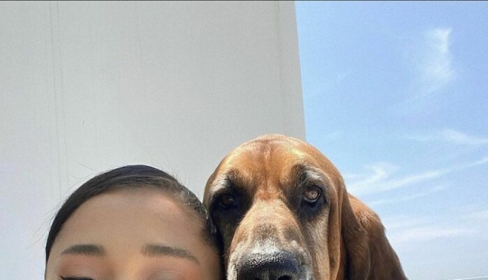 Ariana Grande admite haber usado Botox y rellenos de labios para cambiar su apariencia en el pasado