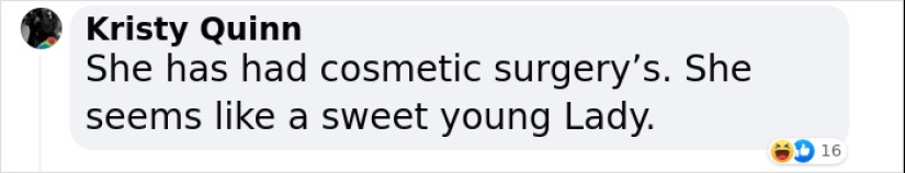 Ariana Grande Admits Using Botox and Lip Fillers To Change Her Appearance In The Past