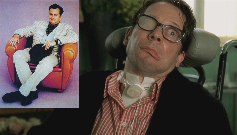 Atrapado en tu propio cuerpo: 5 historias asombrosas