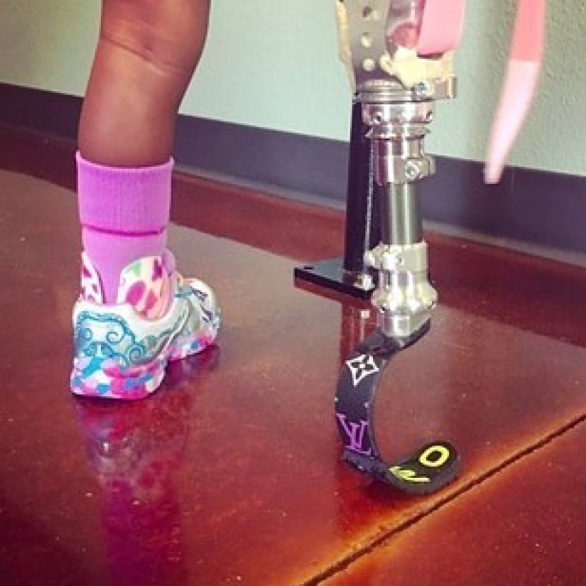 Aurora Cairo is a charming 2—year-old baby with a prosthetic leg Aurora Cairo is a charming 2—year-old baby with a prosthetic leg