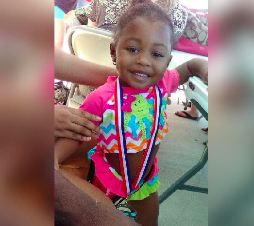 Aurora Cairo is a charming 2—year-old baby with a prosthetic leg Aurora Cairo is a charming 2—year-old baby with a prosthetic leg