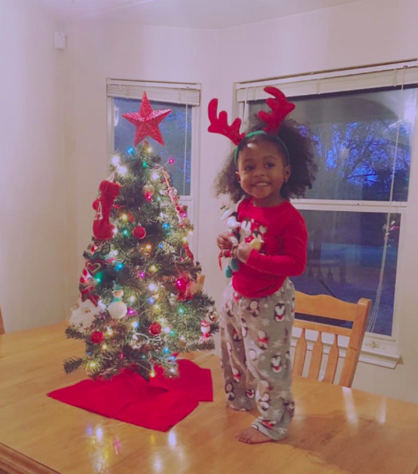 Aurora Cairo is a charming 2—year-old baby with a prosthetic leg Aurora Cairo is a charming 2—year-old baby with a prosthetic leg