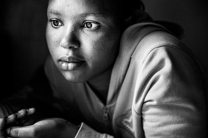 Avoiding female circumcision