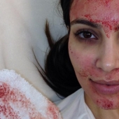 Beauty requires sacrifice: what are the stars doing in pursuit of eternal youth