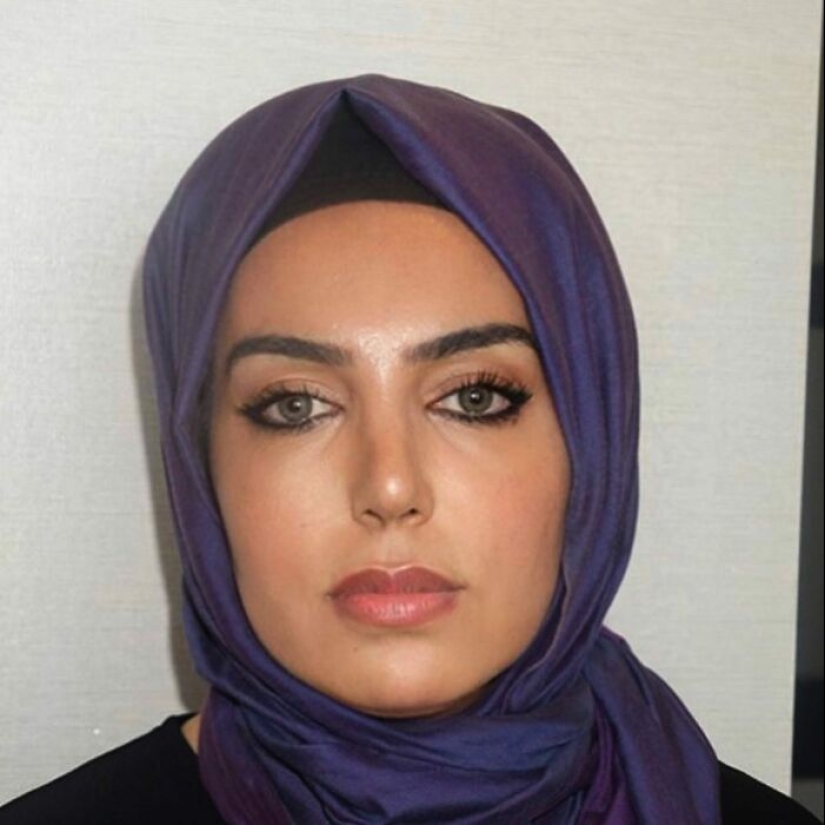 Before And After Photos From Turkish Plastic Surgery Clinic Have Left People Baffled