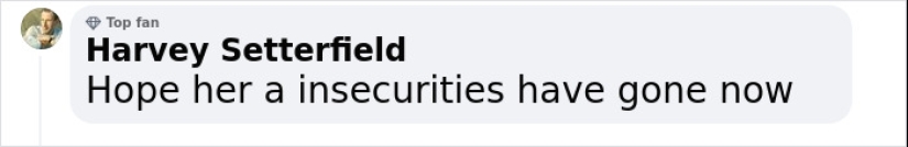 Before And After Photos From Turkish Plastic Surgery Clinic Have Left People Baffled