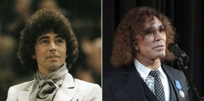 Before fame and plastic surgery: 15 photos of what Russian stars looked like in their youth