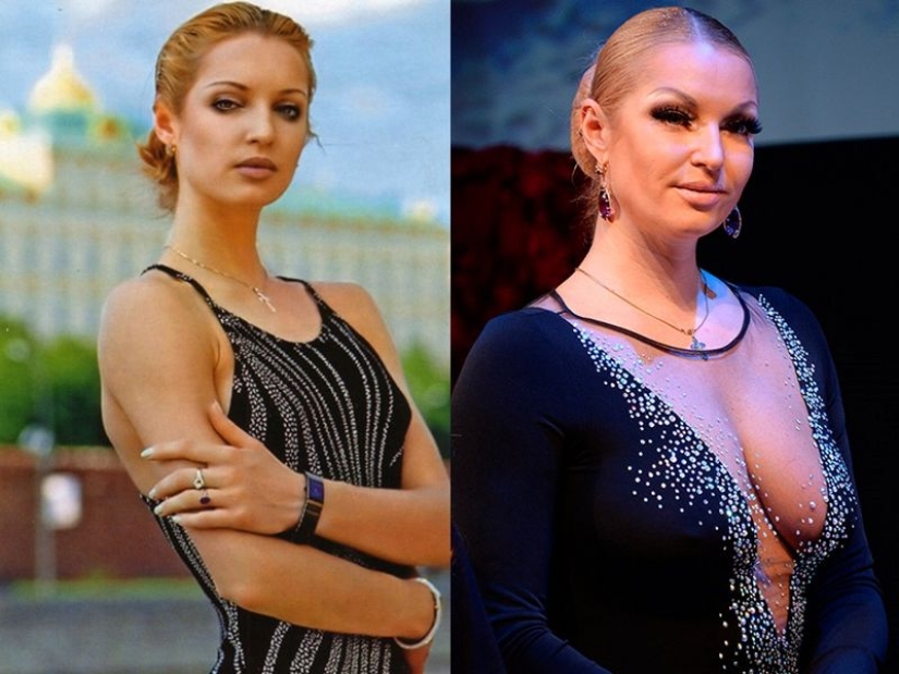 Before fame and plastic surgery: 15 photos of what Russian stars looked like in their youth