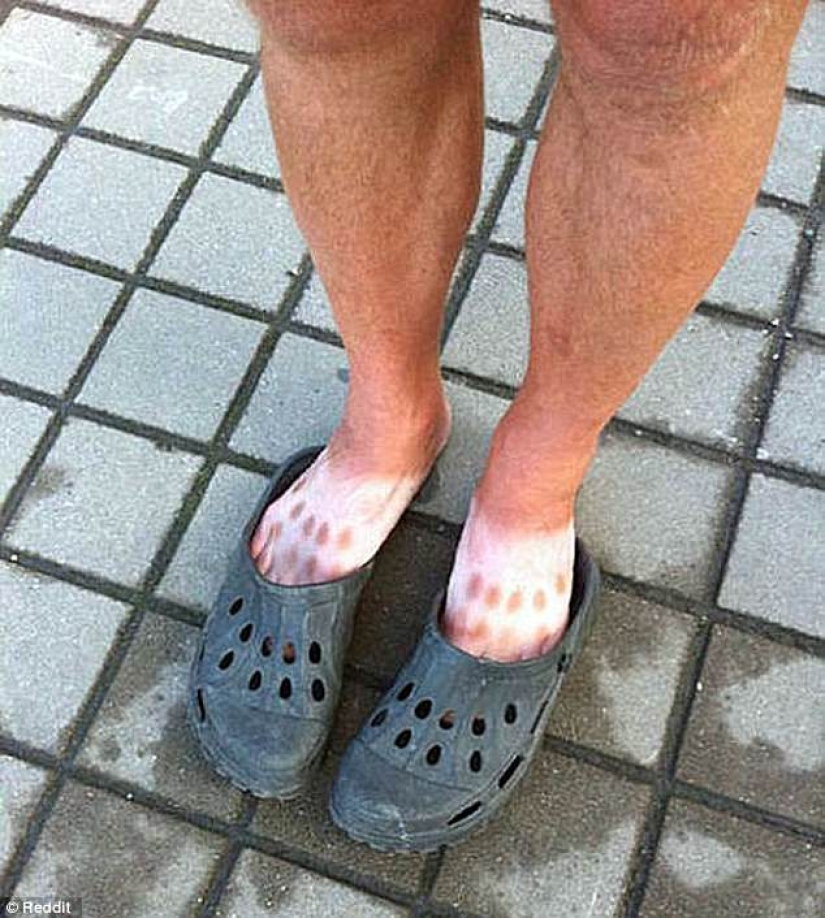 Black on top, white on the bottom — the most failed attempts to tan