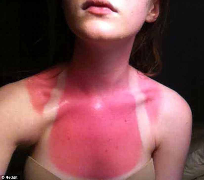 Black on top, white on the bottom — the most failed attempts to tan