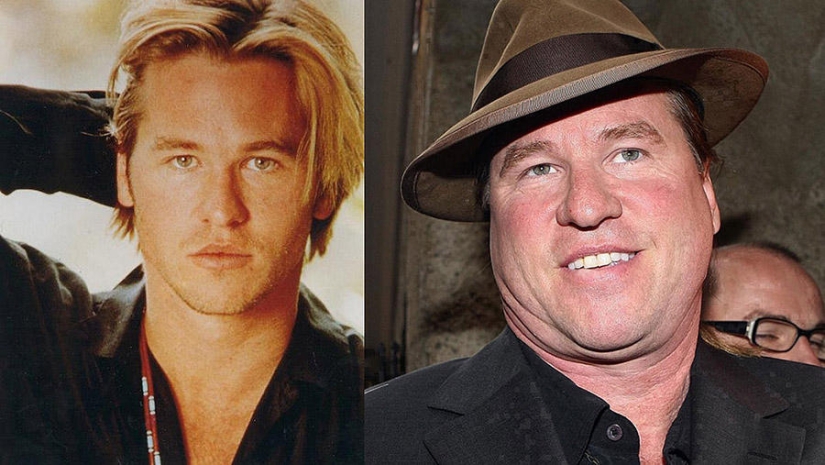 Celebridades que se están poniendo feas