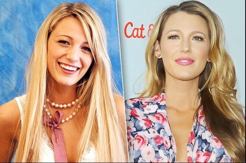 Celebridades que se hicieron un aumento de labios: fotos que sorprenden