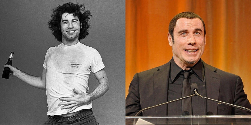 Celebrities who are getting ugly