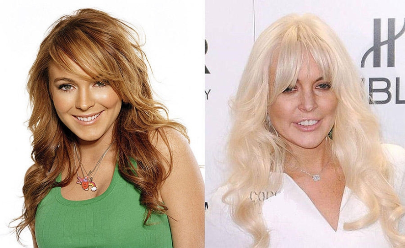 Celebrities who are getting ugly