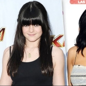 Celebrities Who Had Lip Augmentation: Photos That Surprise