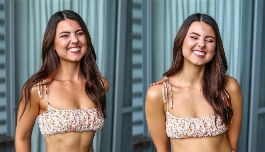 Chica desafía los estándares poco realistas de moda y belleza con sus fotos: 12 fotos