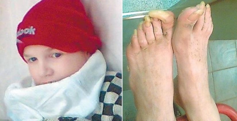 Children taken care of by animals