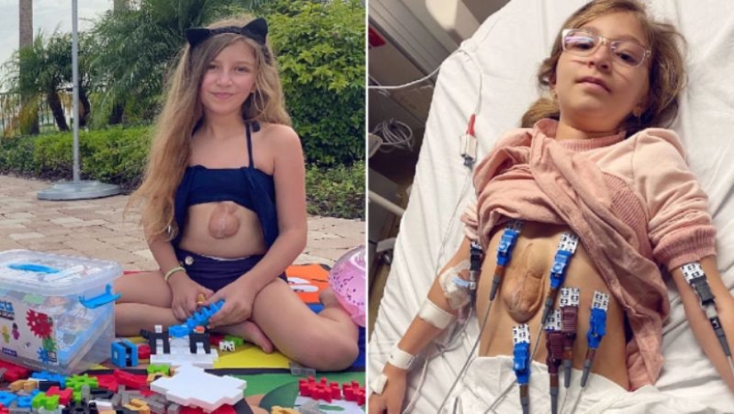 Cómo vive Betsabé: una niña con corazón afuera