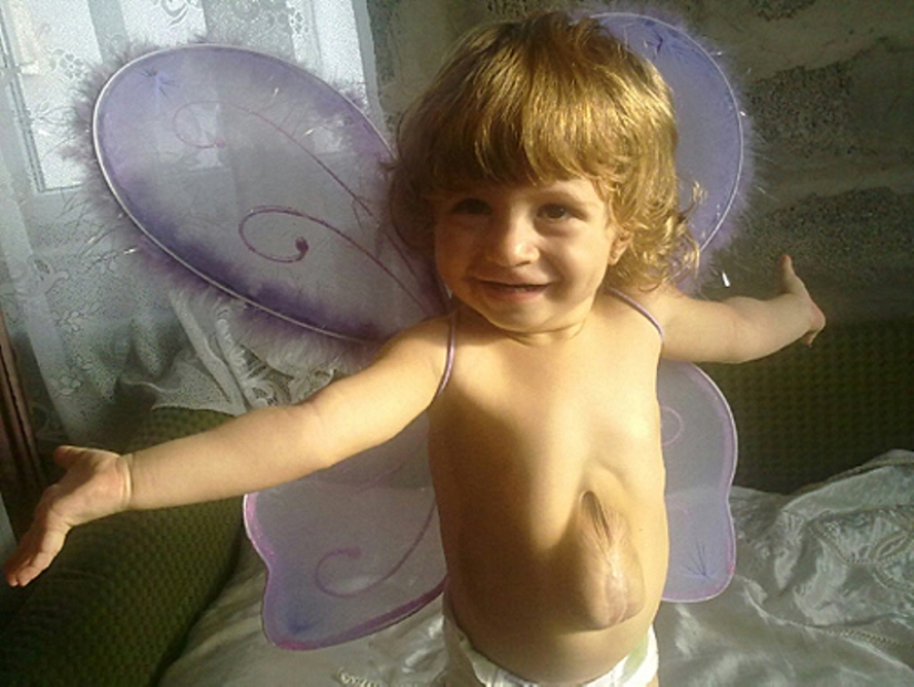 Cómo vive Betsabé: una niña con corazón afuera