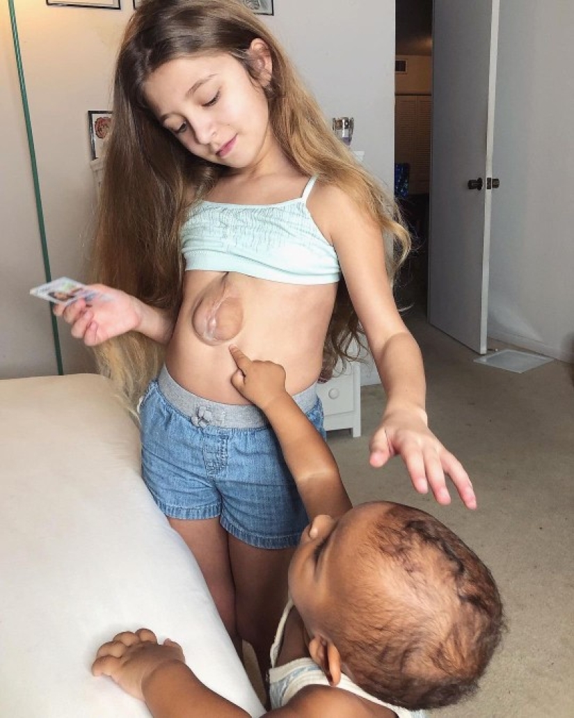 Cómo vive Betsabé: una niña con corazón afuera