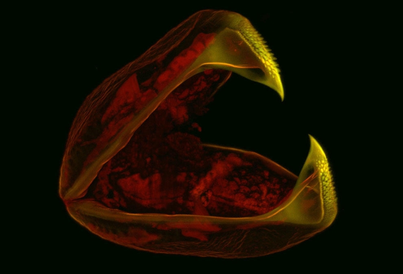 Concurso de fotomicrografía Nikon Small World 2013 Concurso de fotomicrografía Nikon Small World 2013