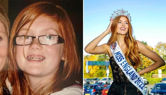 De mujer fea a reina de belleza: una estudiante británica se limpia la nariz ante los infractores De mujer fea a reina de belleza: una estudiante británica se limpia la nariz ante los infractores